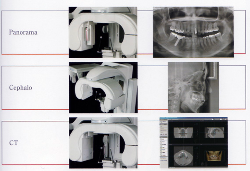 ctscan