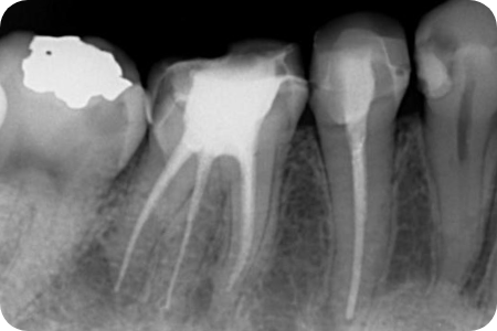 denta4